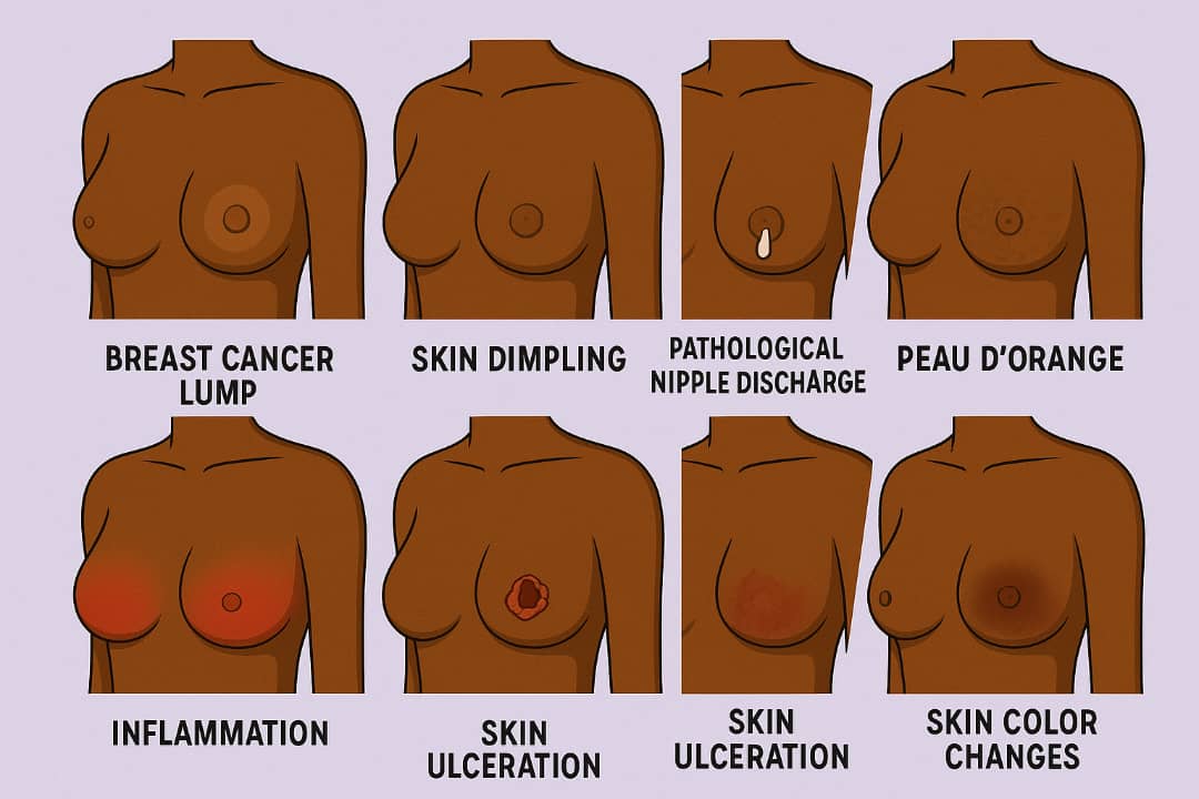 Breast Anatomy